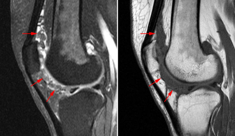 Основные возможности проведения процедуры МРТ коленного сустава